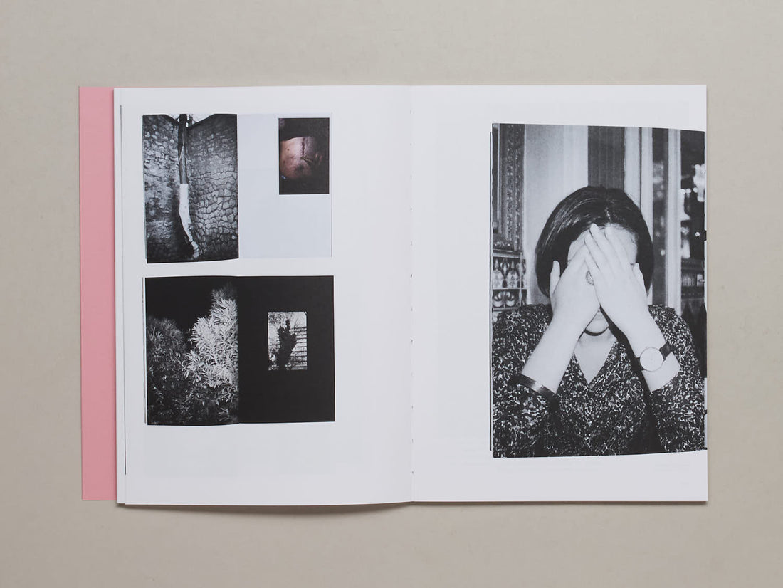 Aftercare: The Eyes #13